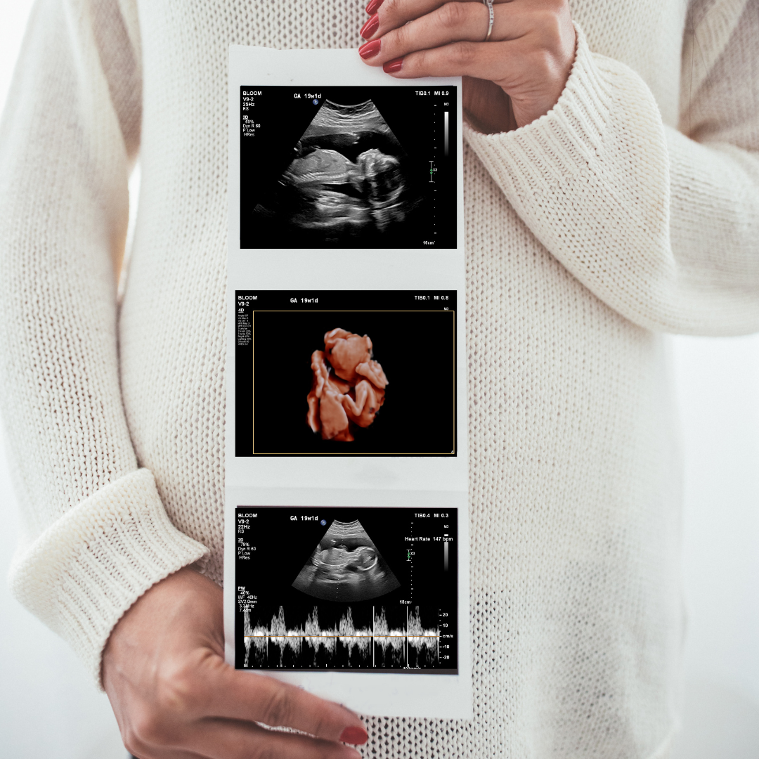 Getting Ready for Your 3D Baby Ultrasound